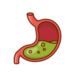 กรดไหลย้อน